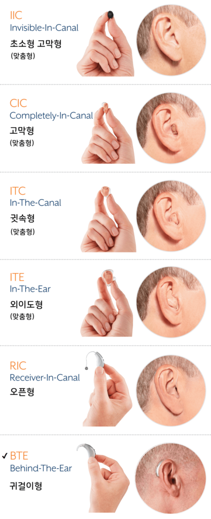 DP 보청기 형태, 청주보청기