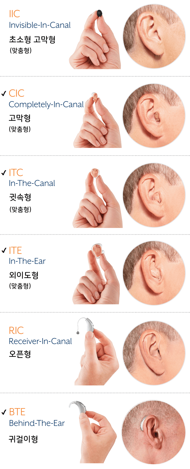 이그나이트 보청기 형태, 청주보청기