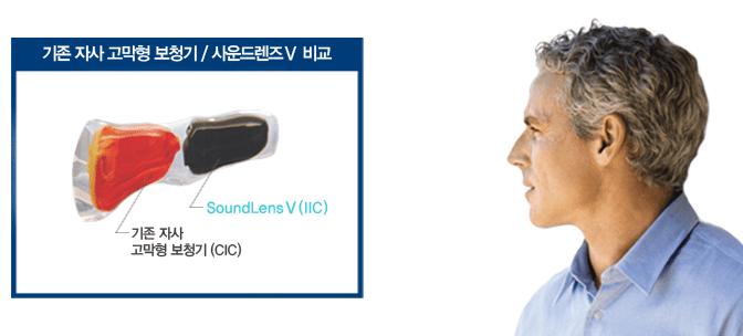 비교, 청주보청기